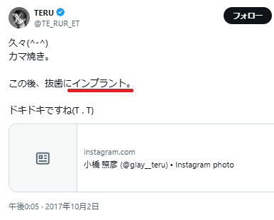 TERUのX